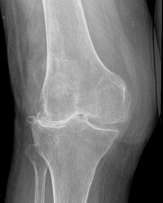 Pathological / Affected Anatomy